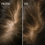 przed:po-serum.png