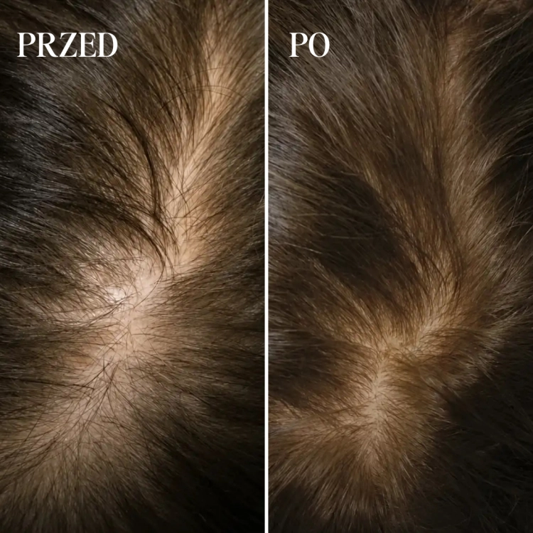 przed:po-serum.png